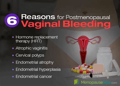 mature women having sex|Vaginal bleeding after sex Causes